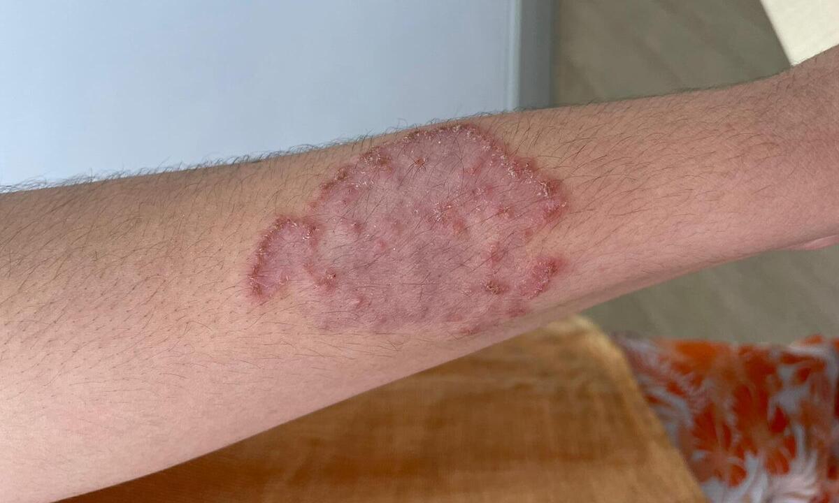 La importancia de acudir al dermatólogo…